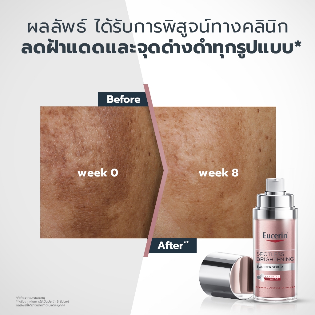 Eucerin SPOTLESS BRIGHTENING THIAMIDOL BOOSTER SERUM 30 ML เซรั่มจัดการฝ้าแดด กระ จุดด่างดำแก้ยาก - รูปที่ 3