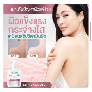[180 ml.] Smooth E เซรั่มบำรุงผิวกาย เข้มข้นระดับโดส จัดการปัญหาผิวตรงจุด พร้อมส่ง (3 สูตร)
