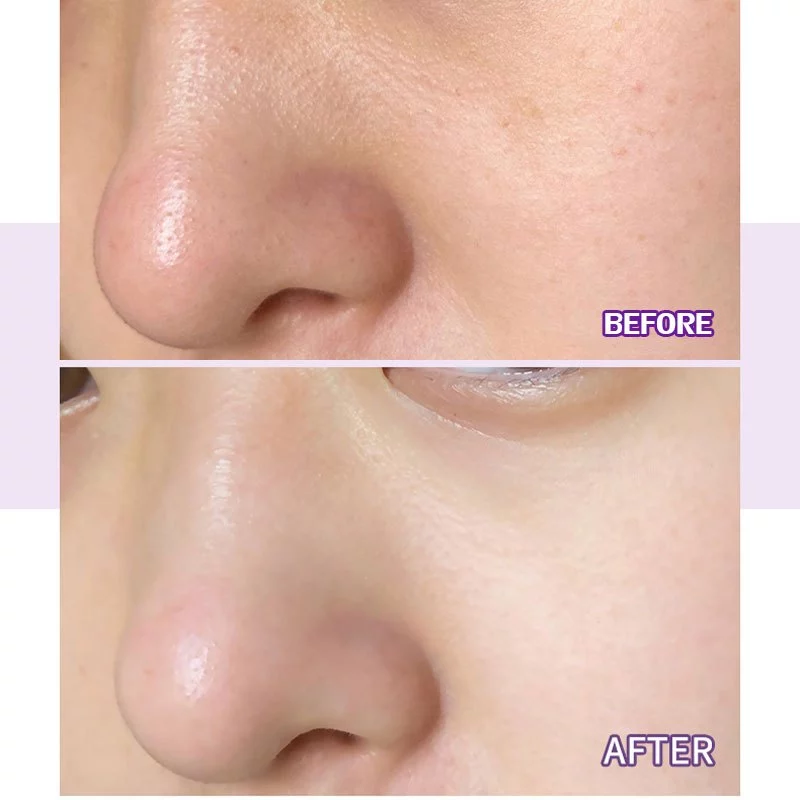 Mask Stick Skincare สกินทิฟิค มาสก์โคลนแบบแท่ง มาร์กโคลน มาร์คหน้า มาร์ค มาส์กโคลน บำรุงผิวหน้า สกินแคร์ thumbnail 8