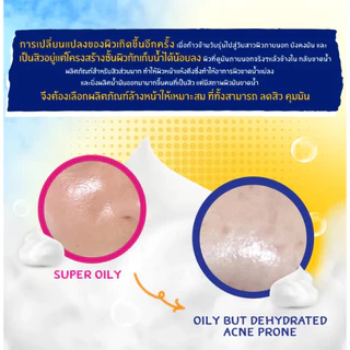 คลีน แอนด์ เคลียร์ โฟมล้างหน้า เซลฟ์โฟมมิ่ง เฟเชียล วอช Clean & Clear Essentials Self Foaming Facial Wash