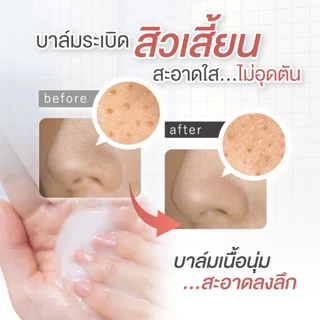 ดูโอ คลีนซิ่งบาล์มสูตร White ผิวสว่างกระจ่างใส ไม่หมองคล้ำ DUO The Cleansing Balm EX White 66g.