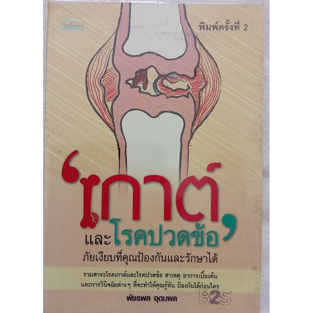"เกาต์ และโรคปวดช้อ" ภัยเงียบที่คุณป้องกันและรักษาได้  โดย  พัชรพล  อุดมผล  (หนังสือมือสอง)