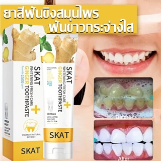 Joy ยาสีฟันขิงขิง SKAT ของแท้ ป้องกันแบคทีเรีย ลดคราบหินปูน ดูแลเหงือก สดชื่นช่องปาก เสริมฟันแข็งแรง ยาสีฟันสมุนไพร