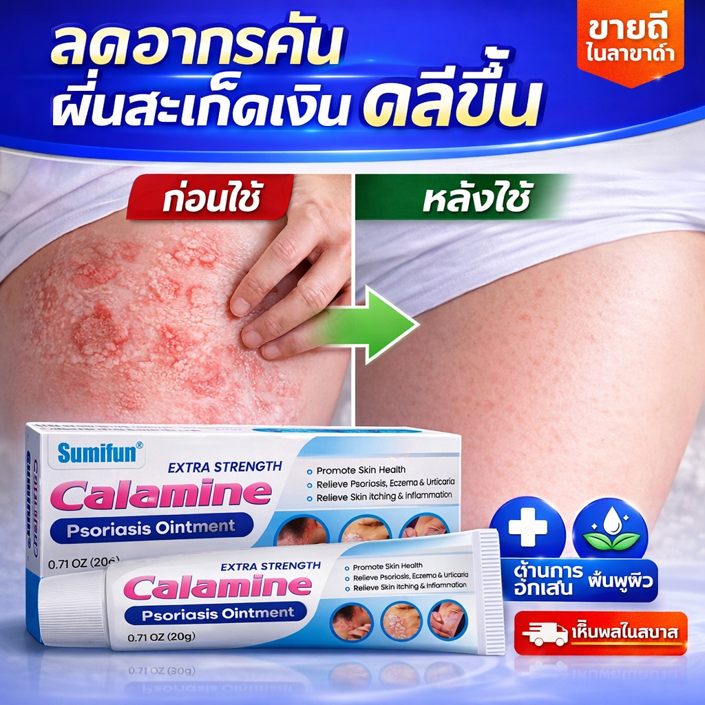ครีมแก้คันผิว ลดผื่นคัน บรรเทาอาการคัน ฆ่าเชื้อรา ฟื้นฟูผิว เห็นผลไว 20G