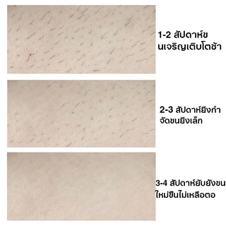 VIVX แว็กซ์น้ำผึ้งกำจัดขน 300g เหมาะขนรักแร้และจุดซ่อนเร้น