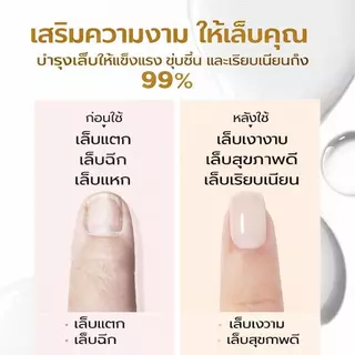 MEFA เสริมความแข็งแรงเล็บ ฟื้นฟูโปรตีน เล็บบางเสียหาย แห้งเร็ว ไม่ต้องใช้ UV 15ml