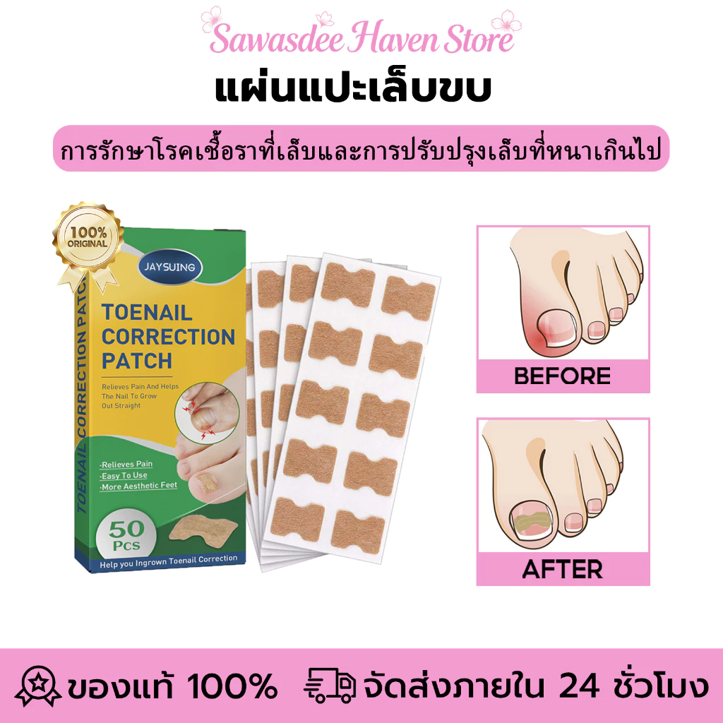 Jaysuing แผ่นแปะเล็บขบ แผ่นปรับรูปเล็บนิ้วเท้า สติกเกอร์แก้ไขเล็บเท้า แผ่นแปะเล็บคุด เล็บขบ ซ่อมเล็บ