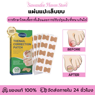 Jaysuing แผ่นแปะเล็บขบ แผ่นปรับรูปเล็บนิ้วเท้า สติกเกอร์แก้ไขเล็บเท้า แผ่นแปะเล็บคุด เล็บขบ ซ่อมเล็บ