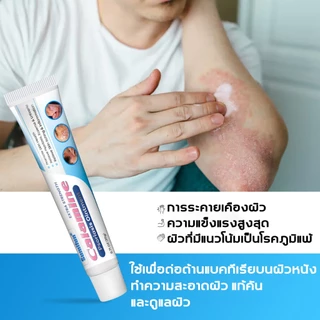 ครีมบำรุงผิวคาลาไมน์ชูเฟน สูตรอ่อนโยน ช่วยบรรเทาอาการผิวแห้ง ลอกเป็นขุย และระคายเคืองได้อย่างมีประสิทธิภาพ ทาบริเวณที่ได