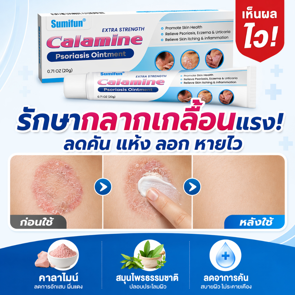 ครีมแก้คันผิว ครีมแก้คัน  สะเก็ดเงิน คัน ผื่นผิวหนัง กลาก เกลื้อน สมุนไพร แก้คัน ฟื้นฟูผิว 20G ครีมลดอาการคัน