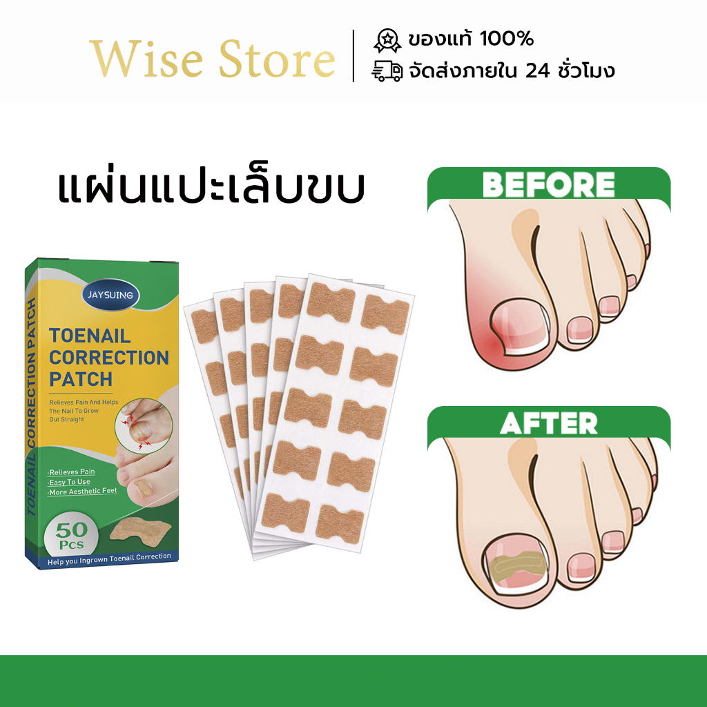 Jaysuing แผ่นแปะเล็บขบ เล็บ ขบ รักษา ที่เล็บขบ เล็บขบ เทปแปะป้องกันเล็บขบนิ้วเท้า แผ่นแปะดูแลเล็บเท้า แผ่นติดเล็บขบ COD