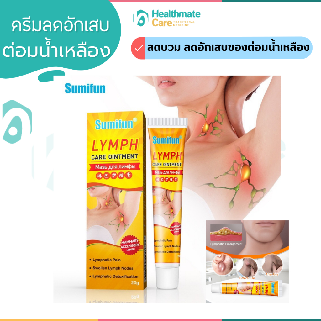 ((พร้อมส่ง)) ครีมทาบริเวณ ต่อมน้ำเหลืองบวม ขนาด20g