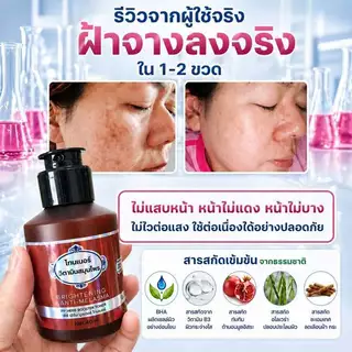 โทนเนอร์เช็ดฝ้า วิตามินสมุนไพร เช็ดฝ้ากระ ผิวกระจ่างใส