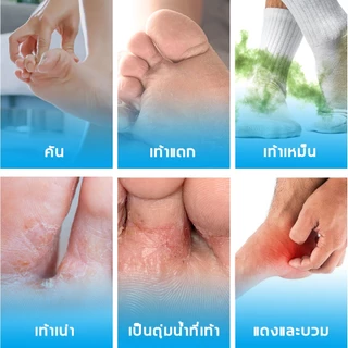 ฆ่าเชื้อโรค ครีมระงับกลิ่นเท้า ครีมทาเท้า บรรเทาคัน ป้องกันเชื้อรา ฟื้นฟูผิวเา ครีมลดกลิ่นเท้า