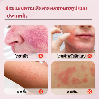 🔥 Sumifun Calamine ครีมบำรุงผิว ลดอาการคัน ผื่นแดง ผิวแห้งแตก ผิวระคายเคือง ดูแลผิวให้ชุ่มชื้น ซึมง่าย ไม่เหนียวเหนอะหนะ