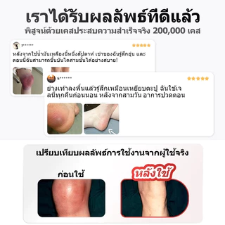 Greenpulse ครีมบรรเทาปวดเมื่อยกล้ามเนื้อและข้อต่อ ช่วยคลายปวดเมื่อยหลัง เหมาะสำหรับคนนั่งทำงานนาน 30g
