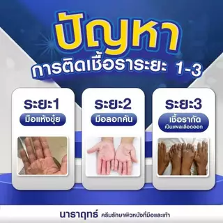 ครีมนาราฤทธิ์ ครีมทาบำรุง มือแห้ง แตก ผิวชุ่มชื้น ขนาด 30 กรัม