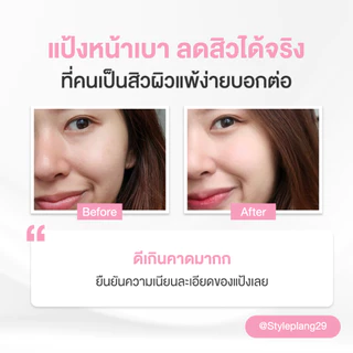 Skinsista แป้งผสมรองพื้น สำหรับคนเป็นสิว ปกปิด บำรุง ลดสิว ลดรอย DREAM LIGHT FOUNDATION POWDER SPF35 PA+++