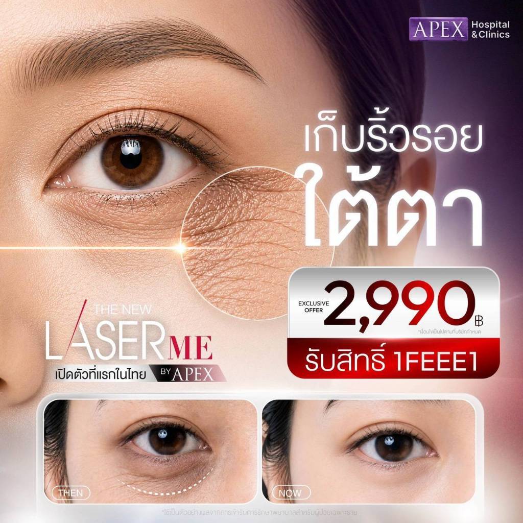 [E-Voucher] APEX โปรแกรม LaserME เลเซอร์ฟื้นฟูผิวลึก เก็บริ้วรอยใต้ตา ไม่ต้องพัก กระตุ้นคอลลาเจน พิเ