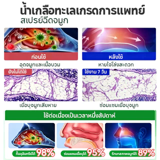 Kreain Nature สเปรย์ล้างจมูก สเปรย์ทำความสะอาดช่องจมูก สูตรธรรมชาติ สเปรย์บรรเทาอาการคันจมูก 30ml