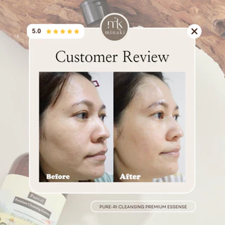 ส่งด่วน 🛵‼️ Pure-ri Premium Cleansing Essence 400ml. เพียวริคลีนซิ่ง คลีนซิ่งผิวกระจก 1 ขวดใหญ่
