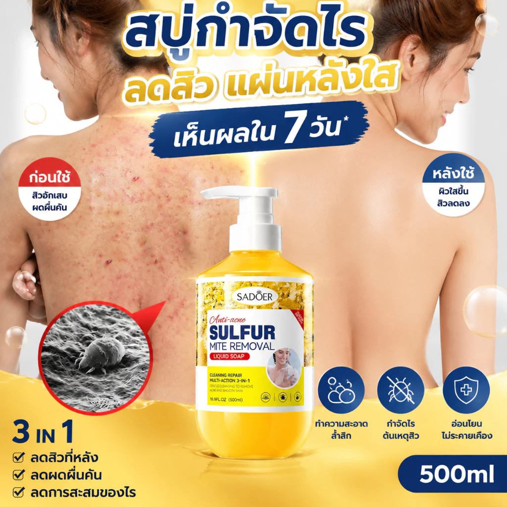 ครีมอาบน้ำลดสิว กำจัดไรเจลอาบน้ํา 500ml ต่อต้านเชื้อราแก้คัน ให้ความชุ่มชื้นอ่อนโยน กลิ่นหอมติดทน ลดสิว กำจัดไร คุมน้