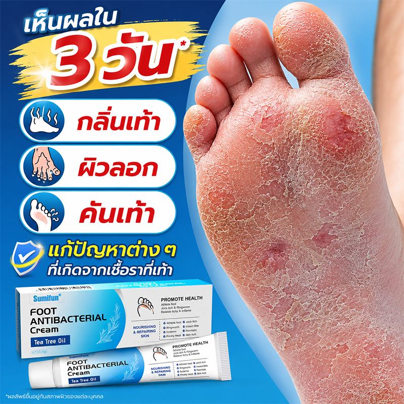 ครีมระงับกลิ่นเท้า ครีมทาเท้า บรรเทาคัน ป้องกันเชื้อรา ฟื้นฟูผิวเา ครีมลดกลิ่นเท้า ครีมบำรุงเท้า Tea Tree Oil