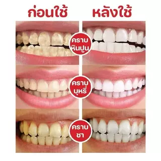 ซื้อยาสีฟัน SP-4 Probiotic Whitening Toothpaste 1 แถม 1 ช่วยให้ฟันขาวขึ้น ลมหายใจสดชื่น และเป็นทางออกสำหรับปัญหาฟันเหลือ