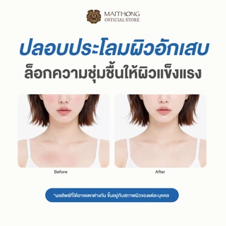 [เซ็ตสุดคุ้ม แพ็ค6] Deejang ดีจัง สบู่บัวหิมะเกาหลี 100g เหมาะสำหรับคนมีปัญหาผิว สิว ฝ้า กระ ผิวเนียนนุ่มสุขภาพดี
