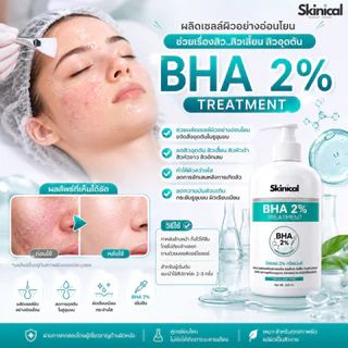 ส่งไว BHA gel 2% เจลลดสิวอุดตัน หัวดำ หัวขาว ละลายหัวสิวอุดตัน ช่วยให้กดสิวง่าย ไม่ทิ้งคราบ