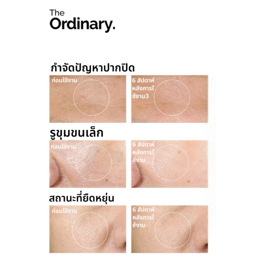 The Ordinary โทนเนอร์ลอกผิว 7% ลดรูขุมขน ให้ผิวสว่าง กระจ่างใสทุกวัน thumbnail 6