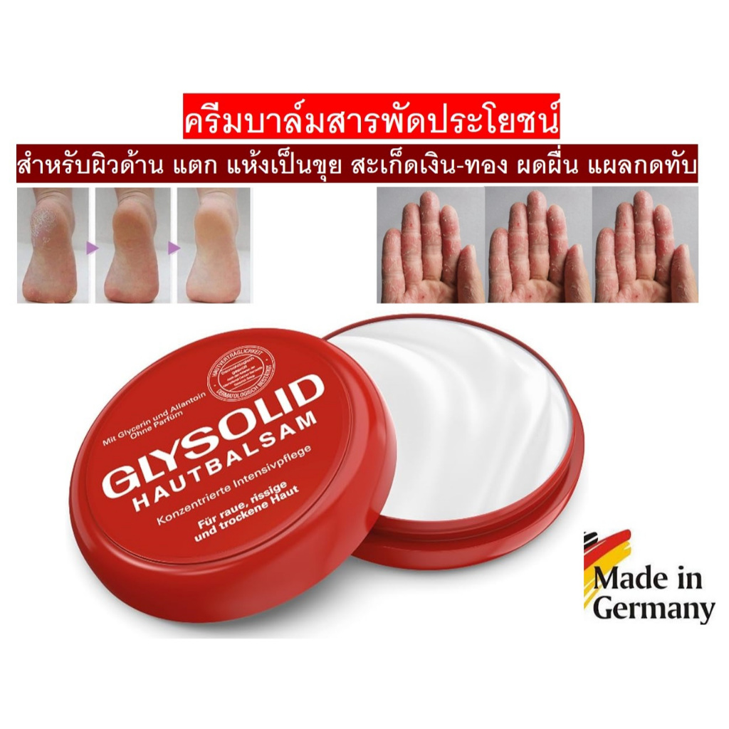 Glysolid Hautbalsam ครีมสารพัดประโยชน์แก้ผิวด้าน แห้ง แตกเป็นขุย สะเก็ดเงิน-ทอง ผดผื่น แผลกดทับ จากเยอรมัน 100ml
