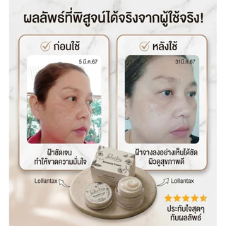 🌈ฝ้าหนาจาง ⚡️⚡️Lalanta Super Melasma Clear ลดฝ้า หน้าขาวใส 🔥