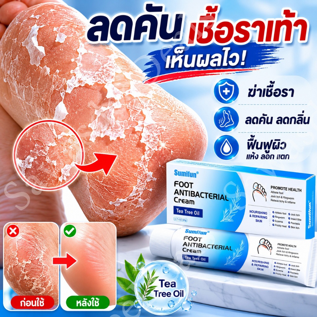 เท้าคัน เท้าเหม็น? อะไรคือทางเลือกที่ดีที่สุด? ครีมทีทรีออยล์ ครีมบำรุงเท้าต้านเชื้อแบคทีเรียและดับกลิ่น ช่วยฟื้นฟูผิว ล