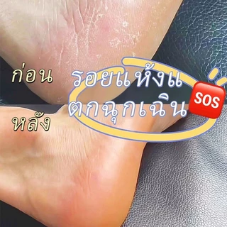 ครีมน้ำมันม้าฟื้นฟูผิวมือเท้า 30กรัม แก้ปัญหาผิวแห้งกร้าน ลดผิวด้านดำ ผิวเนียนนุ่มขาว