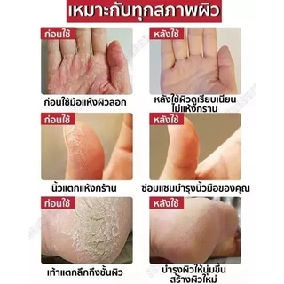 ครีมน้ำมันม้าฟื้นฟูผิวมือเท้า 30กรัม แก้ปัญหาผิวแห้งกร้าน ลดผิวด้านดำ ผิวเนียนนุ่มขาว