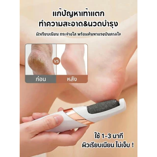 ที่ขัดเท้าไฟฟ้า แก้ส้นเท้าแตก ขจัดหนังด้าน/ผิวตาย ปรับ2ระดับ แถมฟรี!หัวขัด ชาร์จUSB