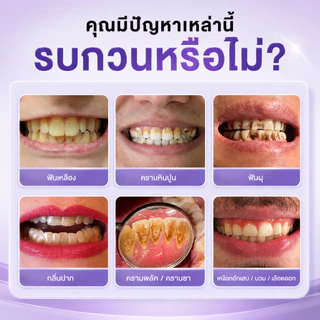 【ซื้อ 1 แถม 1】YOOMU ยาสีฟันสีม่วง ฟอกฟันขาว 50g ลดคราบเหลือง ไฮดรอกซีอะพาไทต์ ลดเสียวฟัน ลดกลิ่นปาก