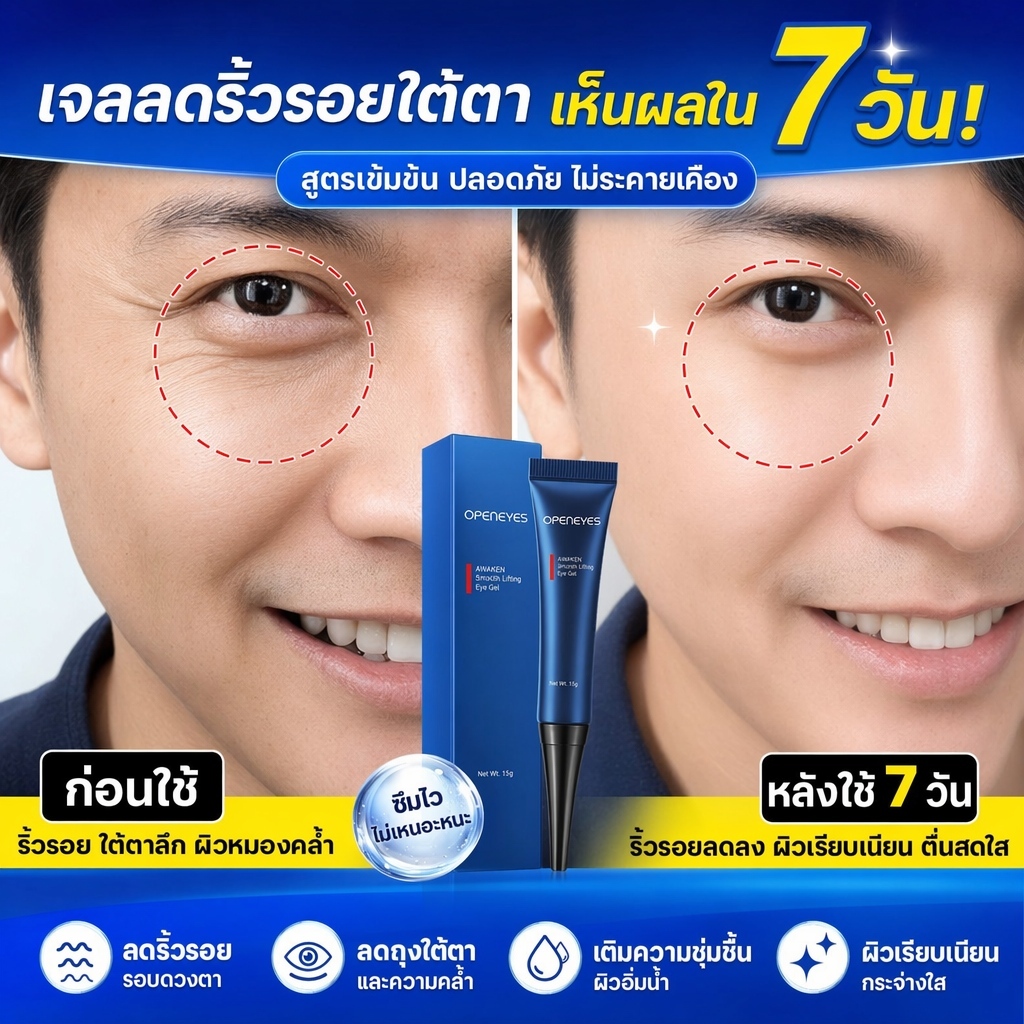 ครีมรอบตาผสานไนอาซินามายด์ 15g กระชับผิว ลดถุงใต้ตาบวม กระจายรอยคล้ำใต้ตา