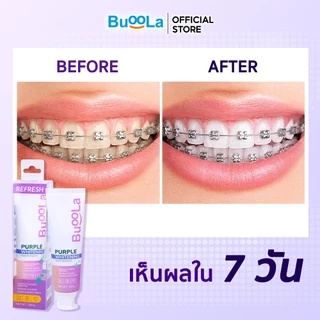 [Set 5 ชิ้นสำหรับคนจัดฟัน ] Buoola ยาสีฟัน+แปรงสีฟัน+แปรงขัดซอกฟัน+แปรงกระจุก+ไหมขัดฟัน