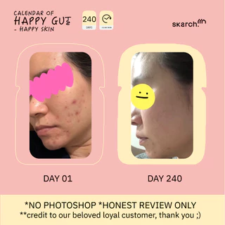 เซตอวสานวงจรสิว [30 วัน - 2 กล่อง] โพรไบโอติก SKARCH PRO+ สิวเรื้อรัง แก้ท้องผูก ผิวใส Pre+Pro+Postbiotic