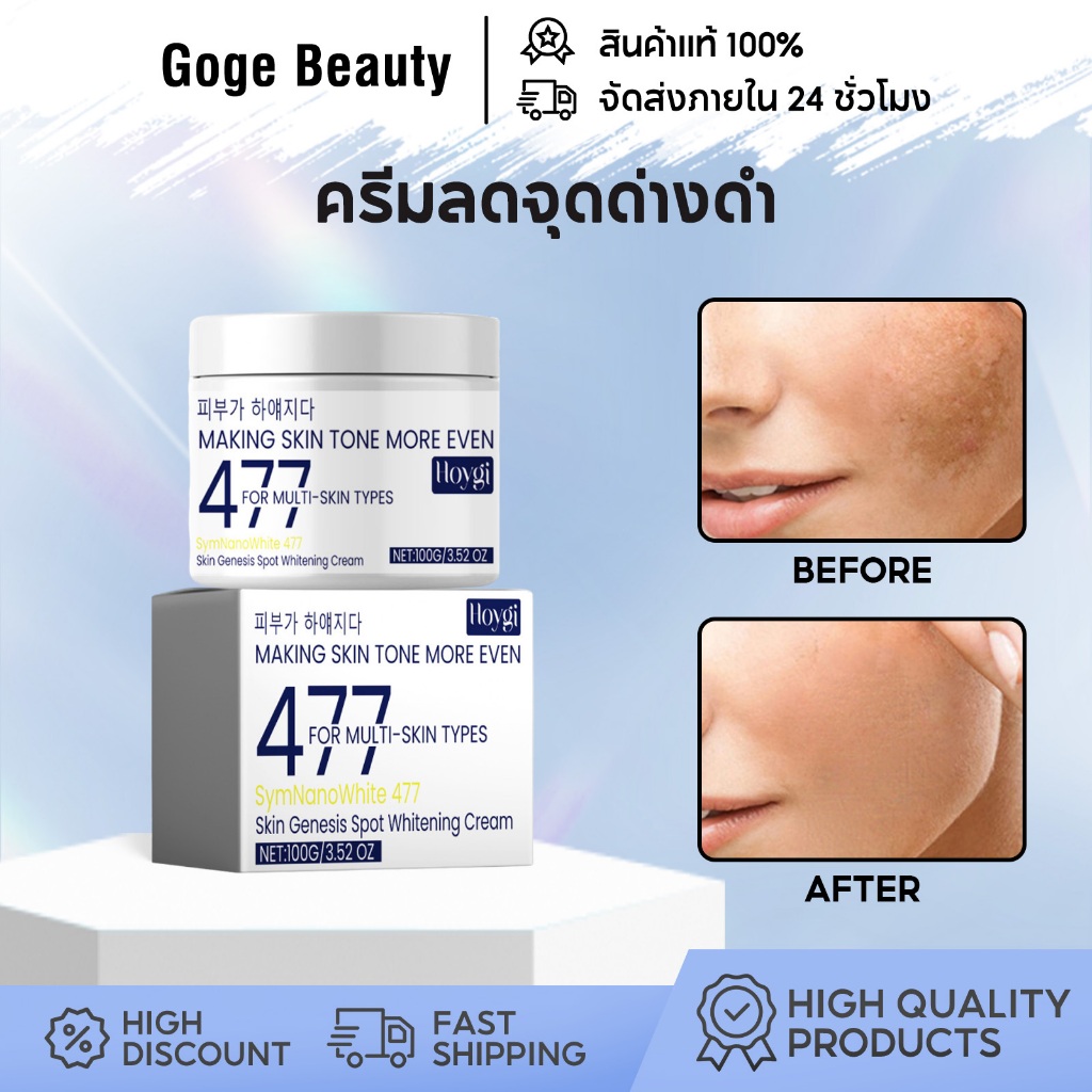 Hoygi ครีม 477 ครีมแก้ฝ้าผิวขาว ผิวขาว ลดข้อบกพร่อง บำรุงผิวโกลว์ ครีมทาหน้า บำรุงผิว ลดริ้วรอย ครีม