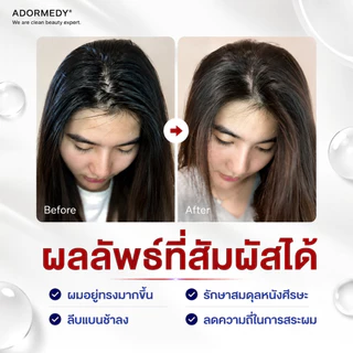 ชาร์โคโลจี Charcoalogy แชมพูถ่านไม้ไผ่สูตรควบคุมความมันหนังศีรษะ 400มล