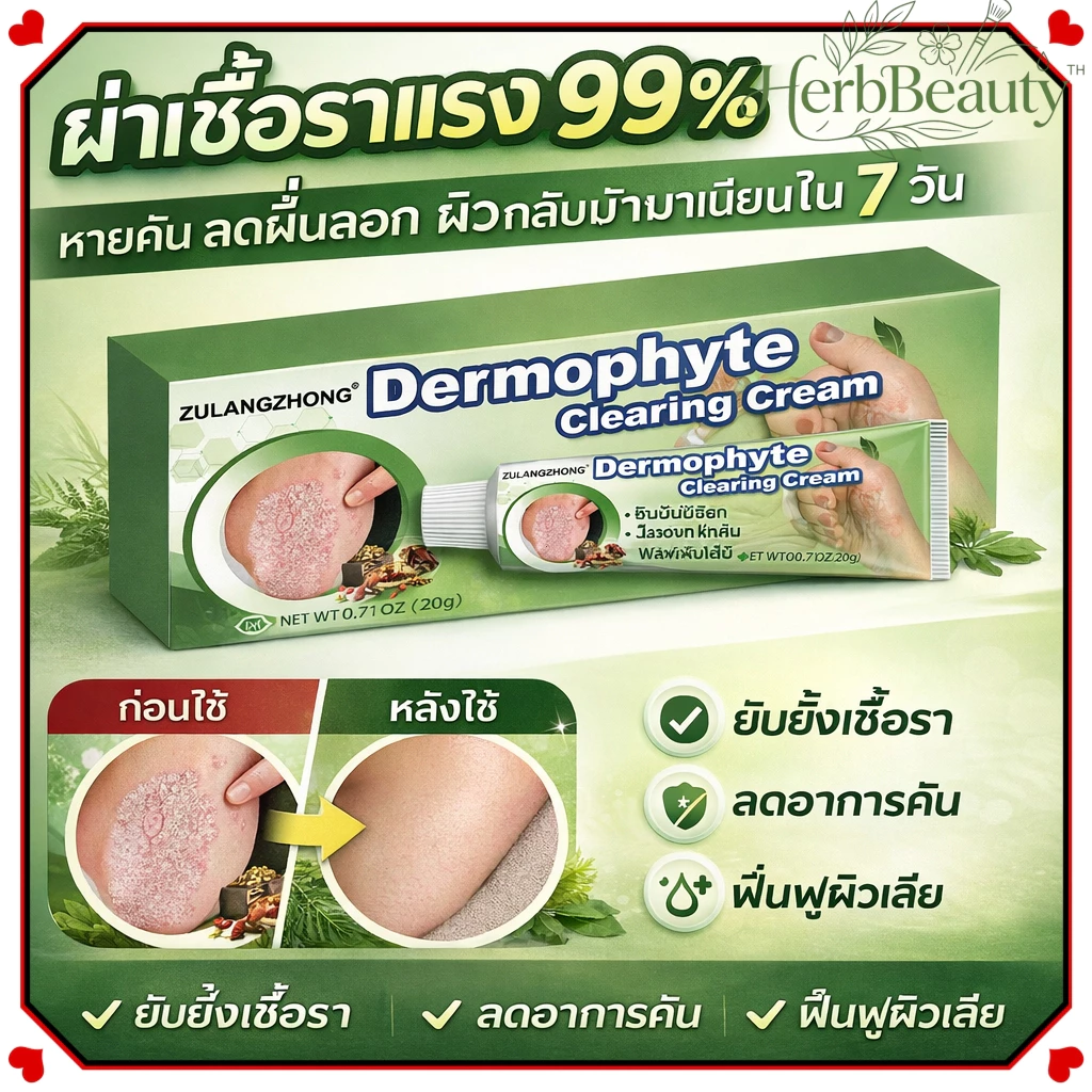 ครีมทาสังคัง สะเก็ดเงินครีม ครีมบำรุงผิว 20g รอยแดง โรคผิวหนัง เกลื้อน กลาก คัน สมุนไพร แก้คันเรื้อรัง คันในร่มผ้า