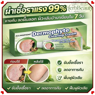 ครีมทาสังคัง สะเก็ดเงินครีม ครีมบำรุงผิว 20g รอยแดง โรคผิวหนัง เกลื้อน กลาก คัน สมุนไพร แก้คันเรื้อรัง คันในร่มผ้า