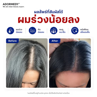 [ชุดคู่] ชาร์โคโลจี แชมพูและครีมนวดถ่านไม้ไผ่ สูตรลดผมขาดร่วง Charcoalogy Revitalizing Shampoo&Condi