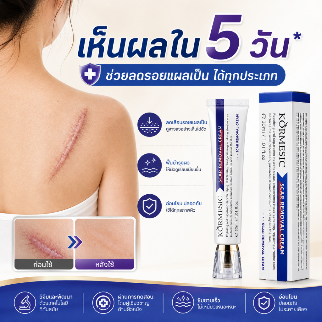 ฟื้นฟู 100%🔥 ครีมลบรอยแผลเป็น เหมาะสำหรับรอยแผลเป็นจากผ่าตัด แผลไฟไหม้ รอยสิว และรอยขีดข่วน ช่วยให้รอยแผลเป็นดูจางลง