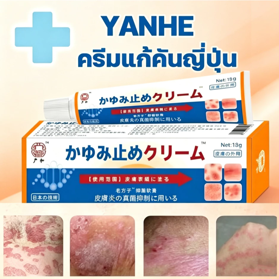 ครีมป้องกันเชื้อรา ครีมแก้คัน ครีมสะเก็ดเงิน บรรเทาอาการคัน ที่มีประสิทธิภาพกับการติดเชื้อที่เชื้อรา กลาก ผื่น ครีมบํารุ