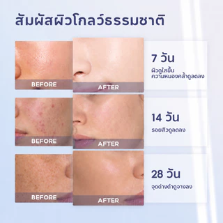 Dr.Lan เซรั่มหน้าใสผิวขาว ลดความหมองคล้ำ ลดฝ้า กระ จุดด่างดำ ผิวแพ้ง่ายใช้ได้ สำหรับผิวหน้า
