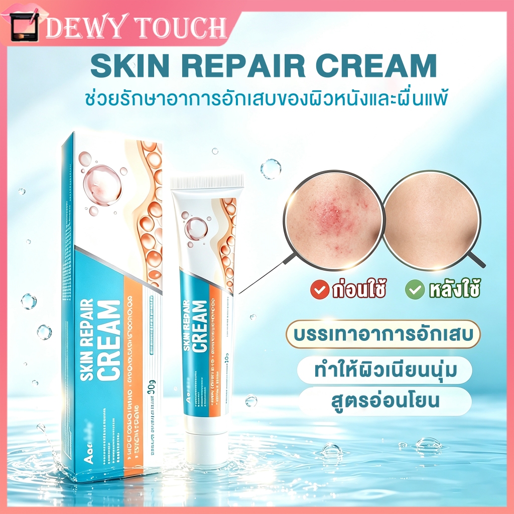 Aeekiy เจลบำรุงสมุนไพร บรรเทาอาการคันผิว สูตรธรรมชาติ บำรุงผิวและให้ความชุ่มชื้นแก่ผิวอย่างอ่อนโยน